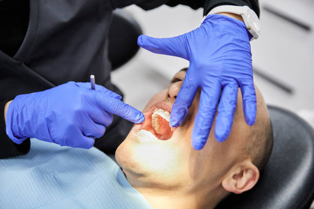 Best Emergency Wisdom Tooth Extraction in Alto, TX